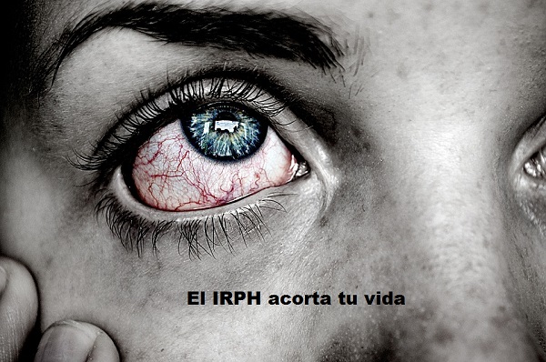 indice IRPH